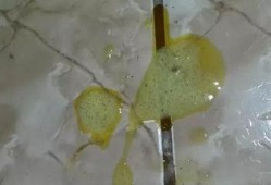 孕期流绿色分泌物（呕吐物为绿色液体什么状况）