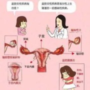 怀孕初期有盆腔炎对孩子有影响吗,盆腔炎症会影响胎儿吗