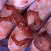 怀孕8周孩子有多大,8周胎儿图片真实图