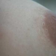 怀孕前期有胸不胀的吗？肿胀和奶水有关系吗,孕期不水肿正常吗