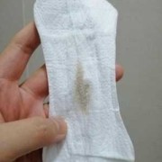 怀孕了有白带异味怎么办,