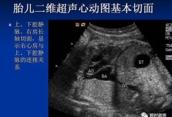 胎儿心动图（胎儿心动图主要检查什么）