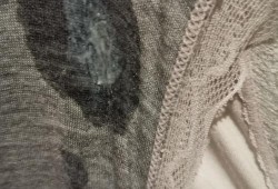 孕期水样白带（白带水状是怎么回事）