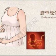 胎儿脐带绕颈两周怎么办（脐带绕颈二周怎么矫正）