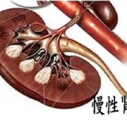 孕期慢性肾炎（孕期慢性肾炎会不会影响宝宝发育?）