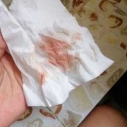 整个孕期见红（整个孕期见红,但宝宝又发育的很好,是怎么回事）