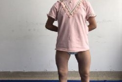 胎儿腿畸形（胎儿腿畸形是什么原因造成的）