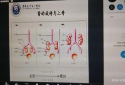 融合肾是什么意思,胎儿融合肾是什么意思