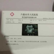 孕期5周（刚知道怀孕5周，可以吃药打胎嘛）