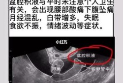 盆腔积液的危害有哪些呢,怀孕检查盆腔积液对胎儿有影响吗