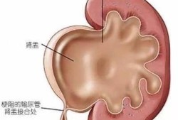 怀孕宝宝肾积水是什么原因,胎儿肾结水是什么原因引起的