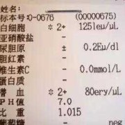 怀孕晚期尿潜血是怎么回事,孕期潜血+-是什么意思