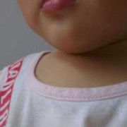 胎儿下巴小（胎儿下巴小会出现什么后果）