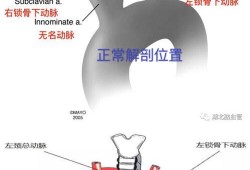 胎儿迷（胎儿迷走右锁骨下动脉什么意思）