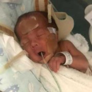 胎儿偏小2周会晚生吗（偏小两周胎儿生下来有没有问题）