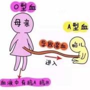 孕期没出过血（孕妇是O型血的话,需要做溶血检查吗）