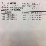 孕妇糖耐量空腹值是5.2，以前没有糖尿病史，这个结果正常吗,孕期血糖5.2需要控糖吗