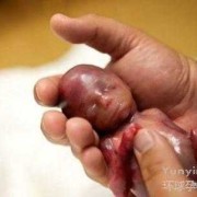 胎儿几周能存活（胎儿几周能存活下来）