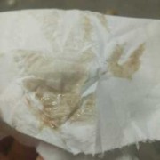 孕期咖啡色（怀孕初期有褐色的东西是什么原因）