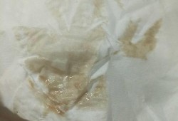 孕期咖啡色（怀孕初期有褐色的东西是什么原因）