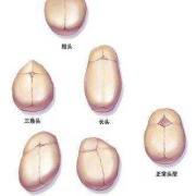 37周胎儿头部偏小怎么办,胎儿头围偏小要补什么营养