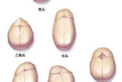 37周胎儿头部偏小怎么办,胎儿头围偏小要补什么营养