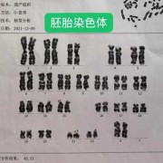 胎儿染色体检查必要吗（胎儿染色体检查什么）