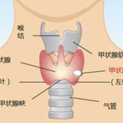 甲亢对胎儿的影响有哪些,老公有甲亢影响胎儿吗