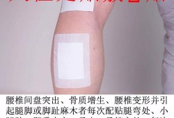 孕期可以贴膏药吗（孕期可以贴膏药吗腰疼）