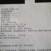 29周胎儿有多大（29周羊水指数正常范围）