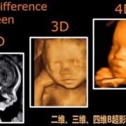 胎儿颜面看不清的图片（胎儿颜面看不清的图片大全）