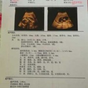 胎儿三级检查（胎儿三级筛查是大排畸吗）