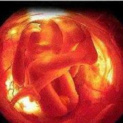 怀孕28周超清晰胎儿图（孕28周胎儿大小标准值是多大的呢）