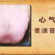 孕妇舌苔发白怎么办？是什么原因,孕期舌苔白厚口苦口臭怎么调理