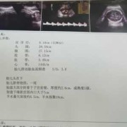 怀孕31周总是胸口闷喘不过气来是怎么回事,胎儿顶在胸口怎么回事