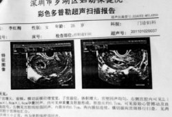 孕妇做彩超对胎儿有影响吗,一个月做了4次b超对胎儿有影响吗