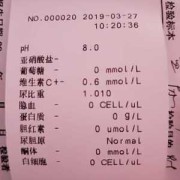 孕期尿检值（孕期尿检值多少是男宝）