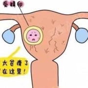 受精卵着床后症状有什么,孕期着床有哪些现象和症状