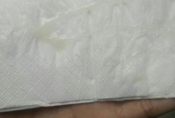 孕妇白带多怎么回事,