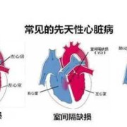 胎儿心脏间隙（胎儿心脏间隙大是什么原因）
