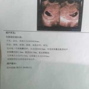 胎儿几周能听到胎心（胎儿几周能听到胎心胎芽）