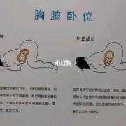 臂位胎儿怎样睡好（臂位胎儿怎样睡好）