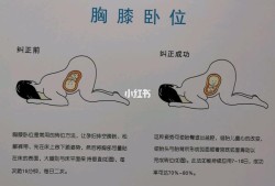 臂位胎儿怎样睡好（臂位胎儿怎样睡好）