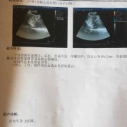 孕32周，彩超发现胎儿腹部有一个5×4.5的囊性团块，怎么办啊,孕32周胎儿彩超指标