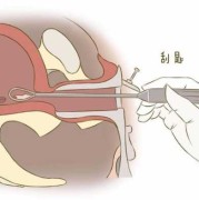 清宫的胎儿（清宫的胎儿怎么处理）