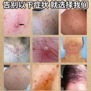 孕晚期外阴瘙痒怎么办，白天还好，晚上睡觉痒,孕期晚上皮肤痒白天不痒