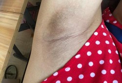 孕期脱毛（孕期脱毛有什么影响）