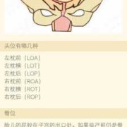 胎儿右枕后位图片（胎儿右枕后位图片）