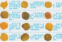 孕期大便少（新生儿尿多大便少怎么回事）
