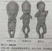 胎儿胎头大怎么办（胎儿胎头大怎么办啊）